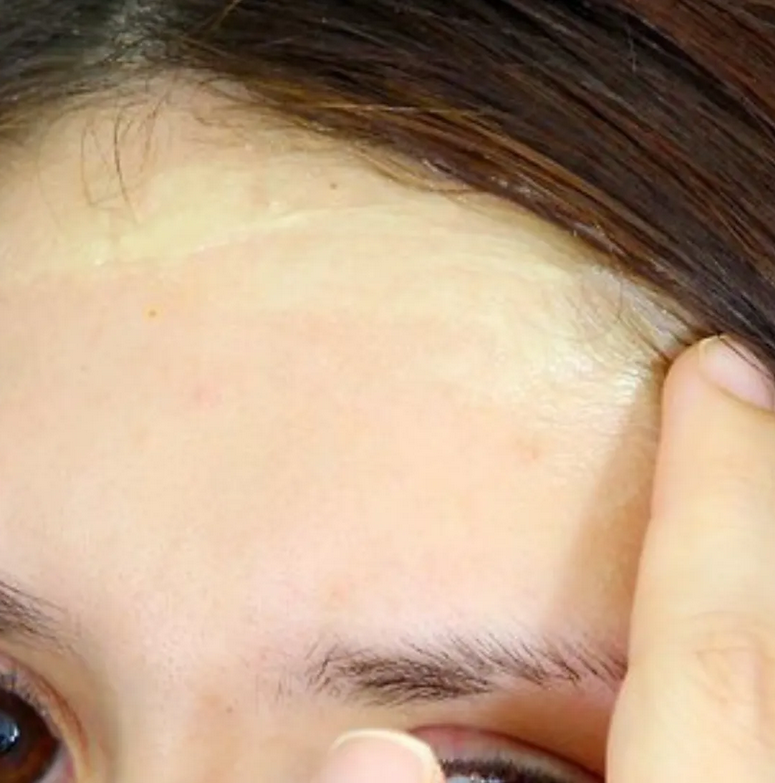 Apply Cream or oil: