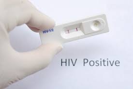HIV Test Kit Supplier  in Nigeria