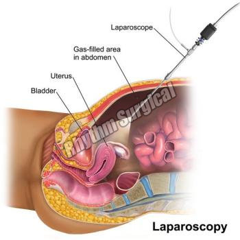 Laparoscopy Products