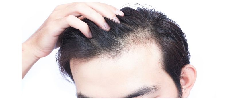 Is Hair Weaving a Healthy Solution for Managing Hair Loss?