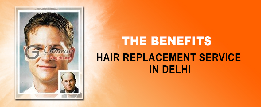 What Are The Benefits of Hair Replacement Service in Delhi?