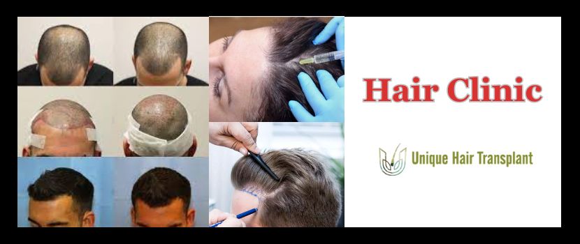 Best Hair Clinic in Hubli