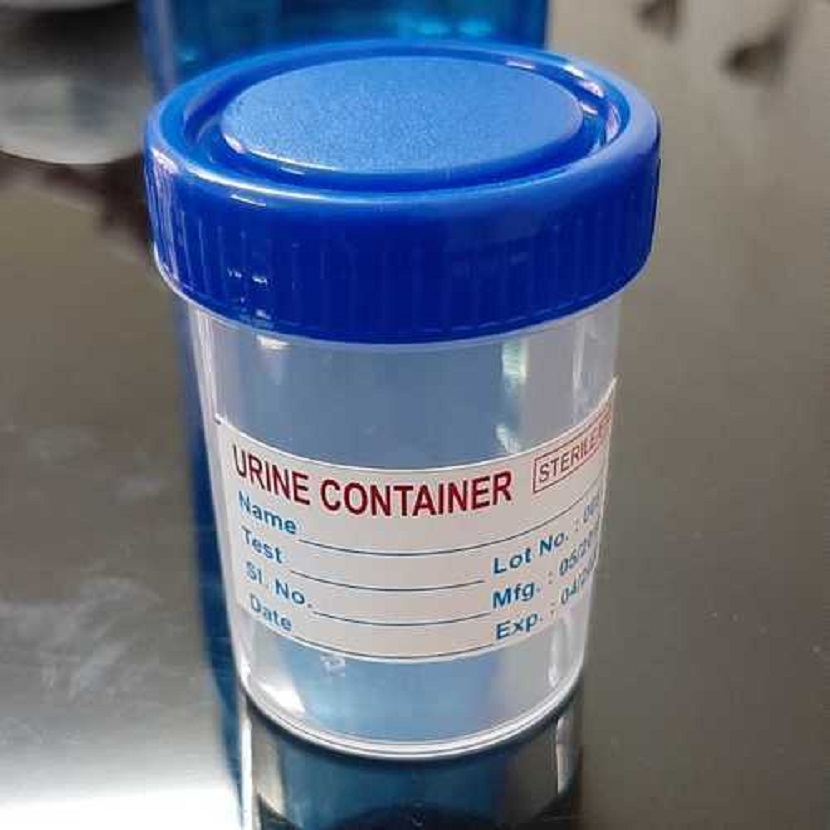 What Is a Urine Sample Collection Container and Why Is It Important?